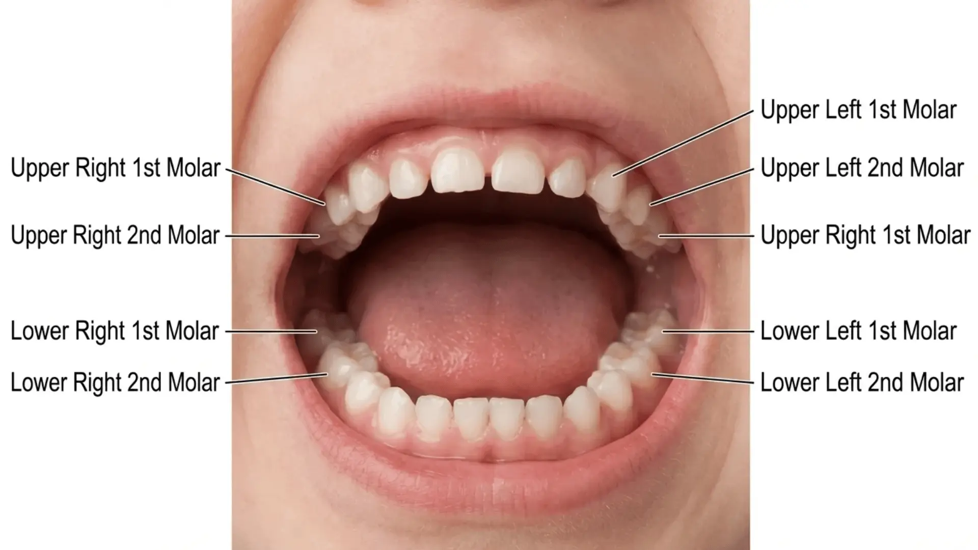 Toddler mouth diagram showing positions of first and second molars in upper and lower jaw