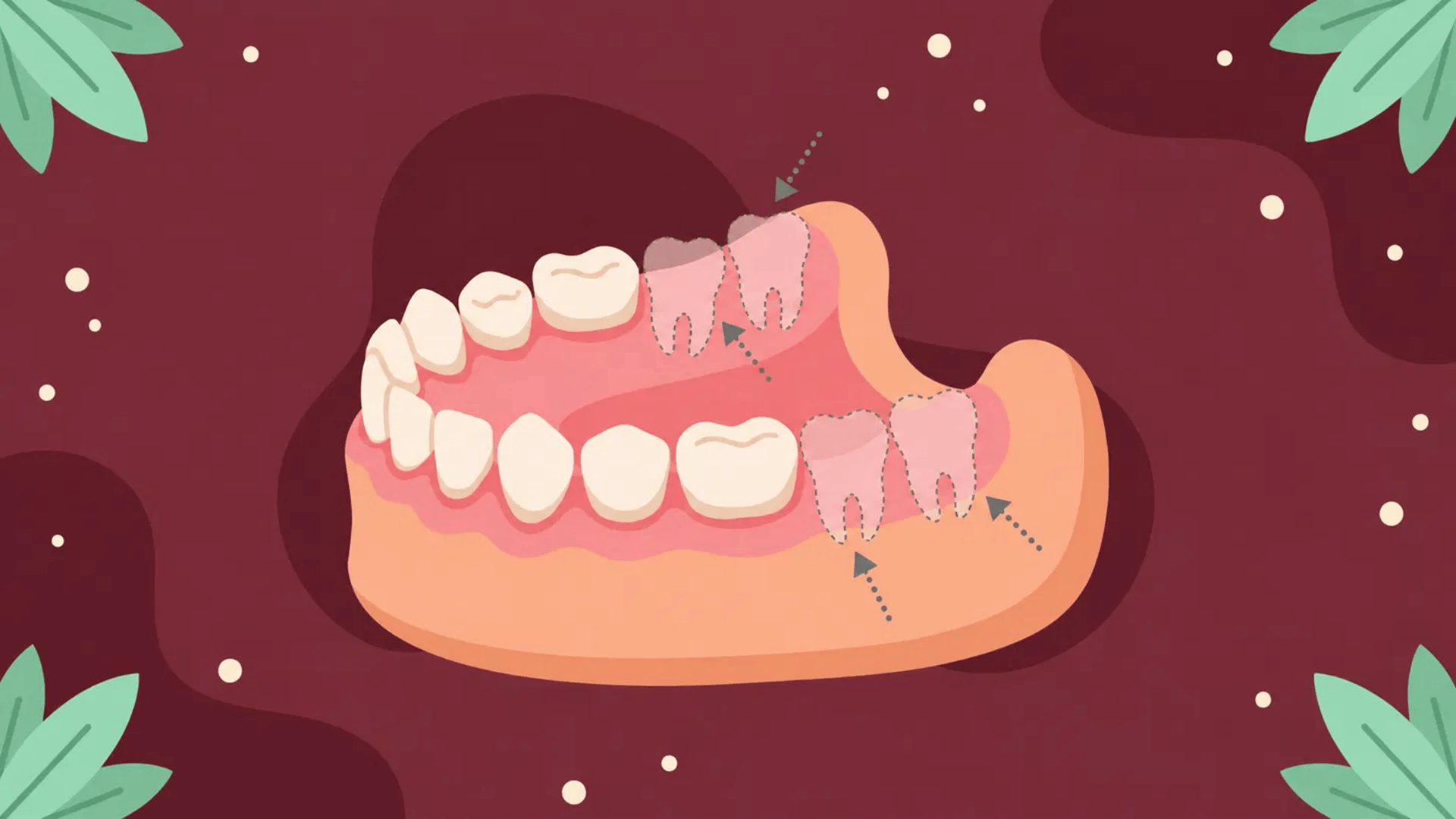 permanent molars emerging behind baby teeth in a cartoon jaw during the mixed dentition stage