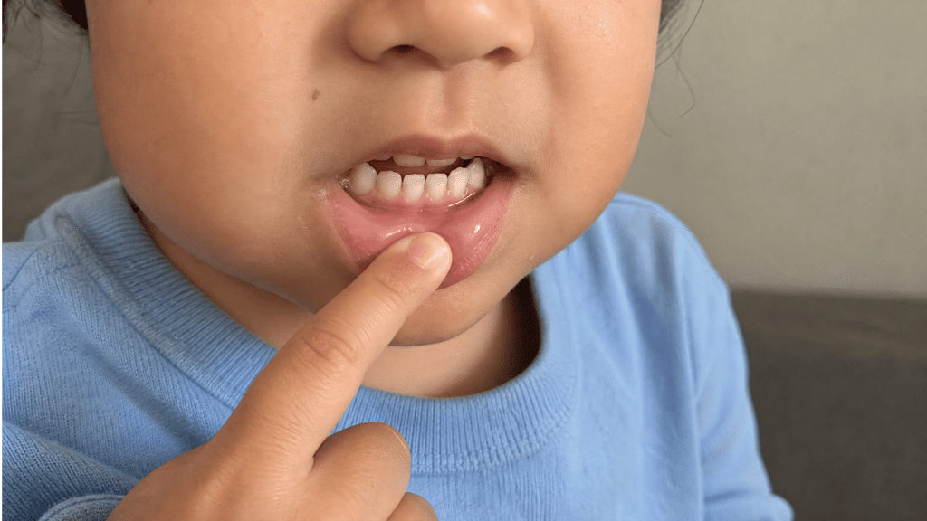 toddler showing baby teeth with finger gently pulling lower lip during teething stage close up view